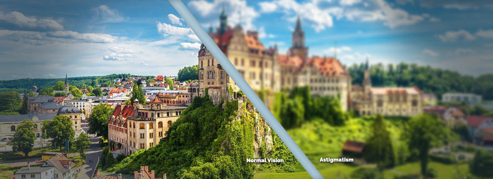 Astigmatism Treatment in Sylvania