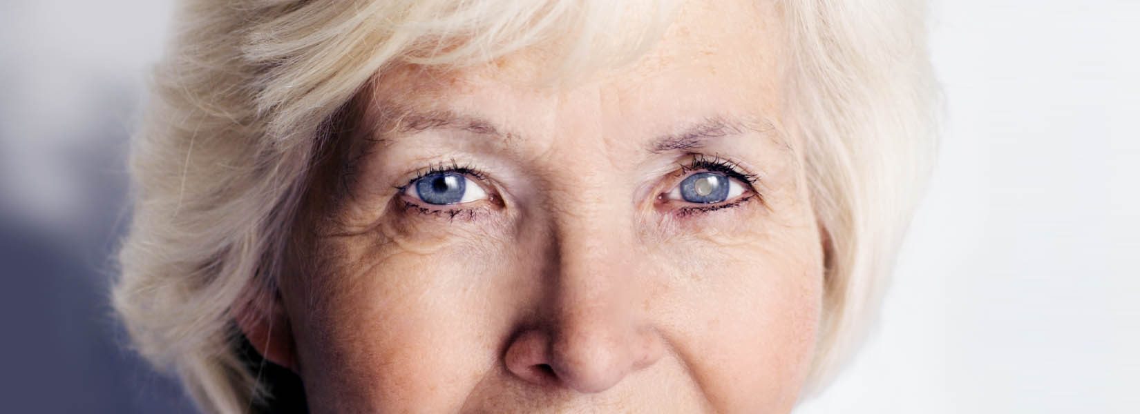 Cataract Surgery in Sylvania